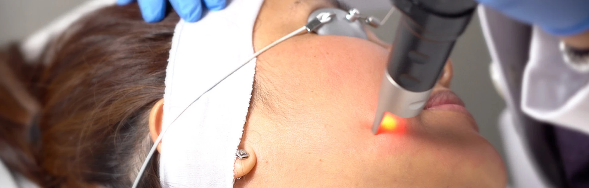 Perfect Skin and No Downtime with Picosure | RenewMD
