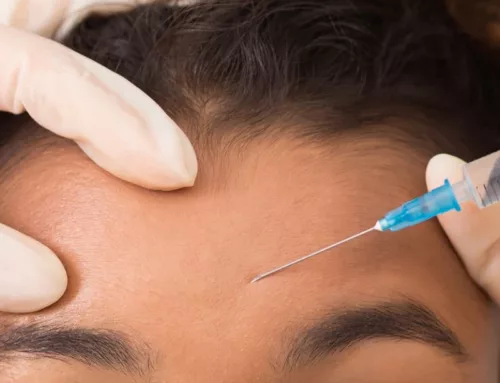 5 Botox Danger Zones: Ensuring Safe and Effective Treatments