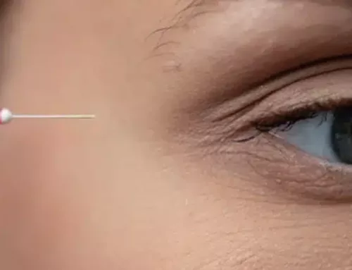 PRP Under Eyes: A Natural Solution for Rejuvenation