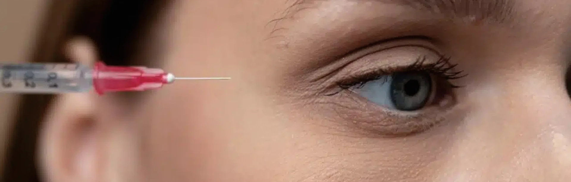 PRP Injections Under the Eyes | RenewMD