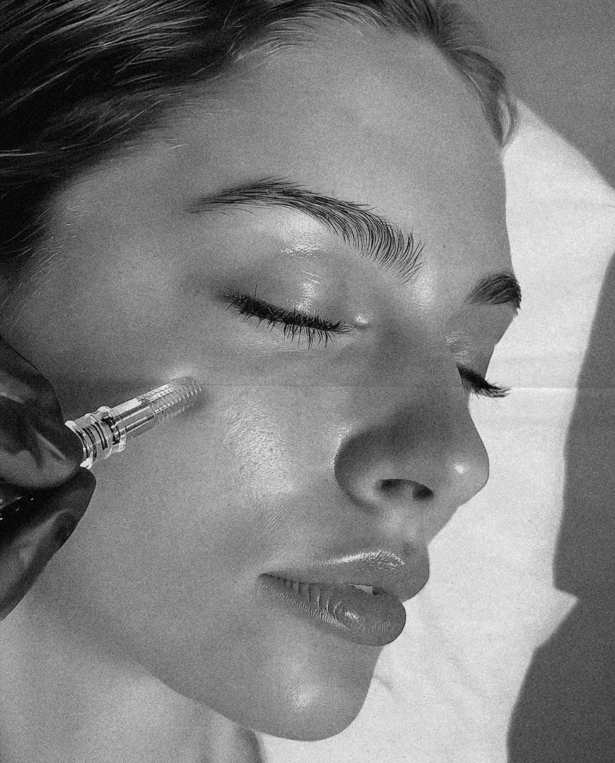 Placental Cells using Microneedling (PDPA) | RenewMD Aesthetic & Wellness