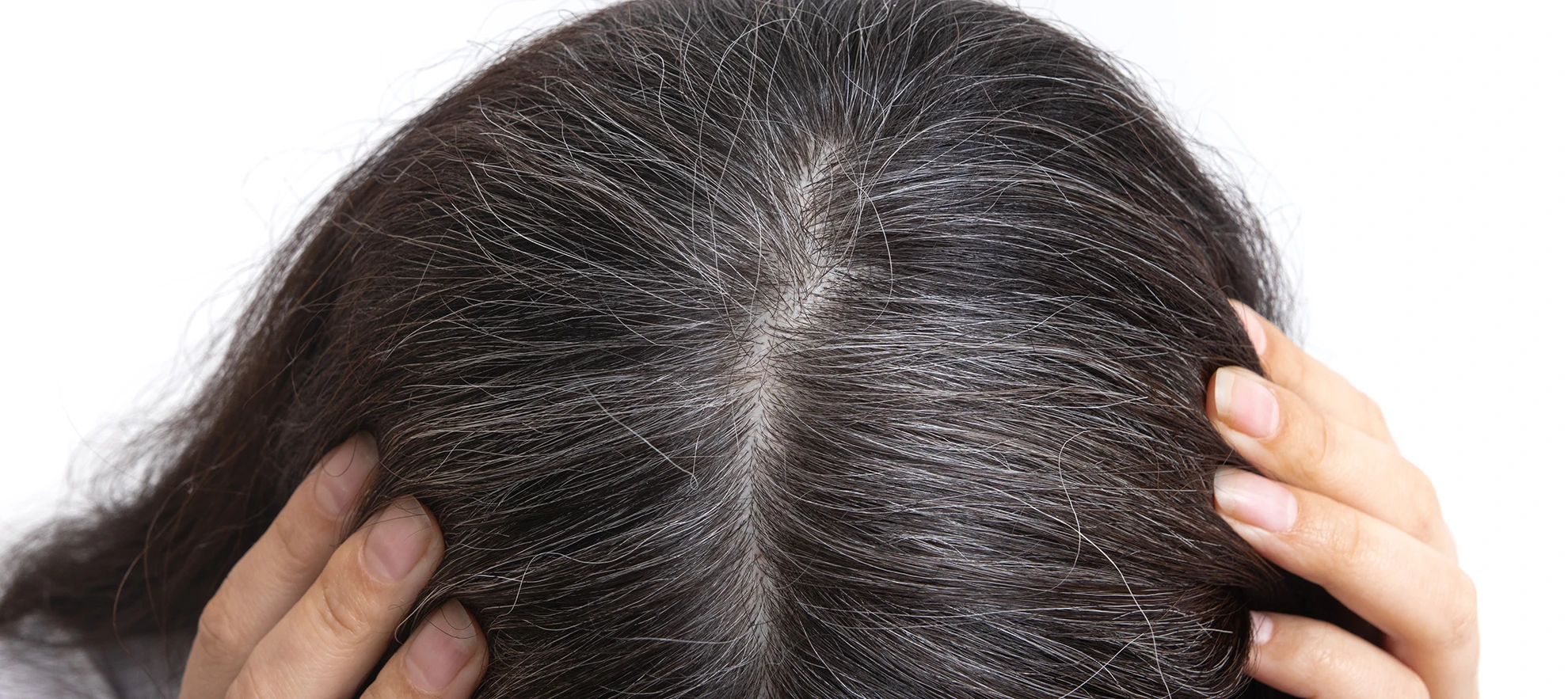 Menopause and Hair Loss