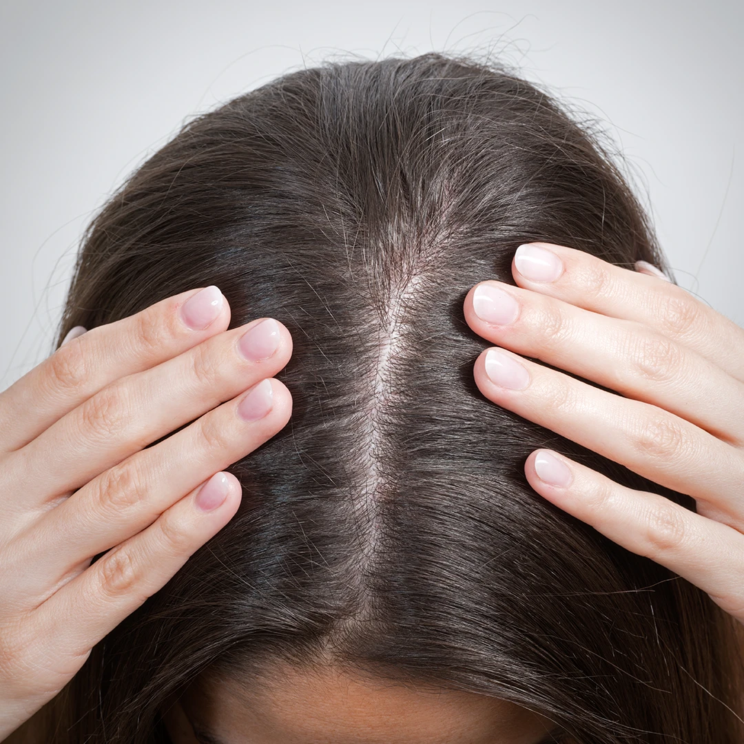 The Biology of Menopause and Hair Loss