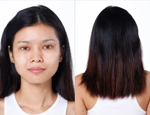 How to Get Rid of Dark Spots: The New 2026 Science Behind Hyperpigmentation Treatments for All Skin Tones
