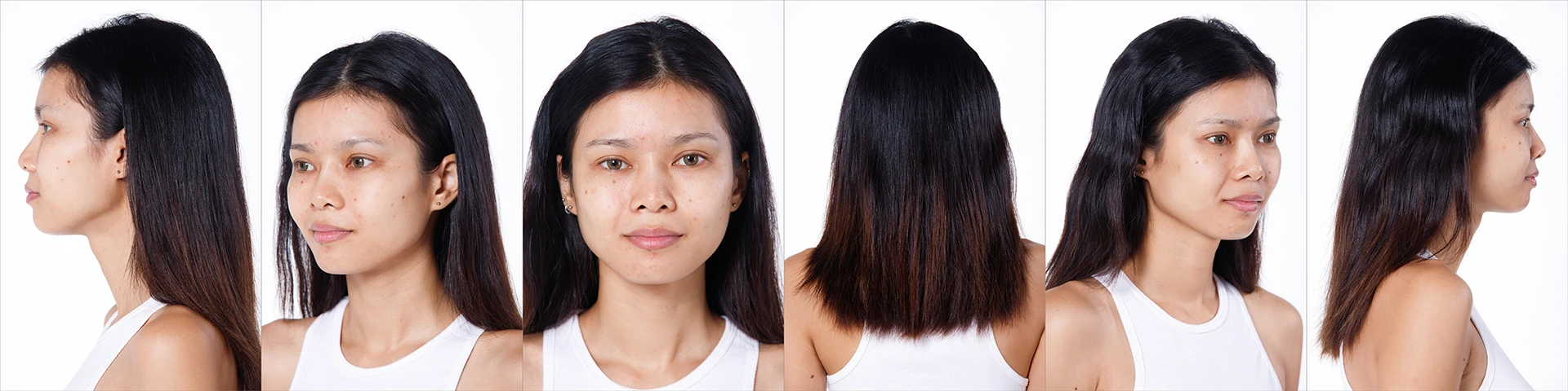 How to Get Rid of Dark Spots: The New 2026 Science Behind Hyperpigmentation Treatments for All Skin Tones