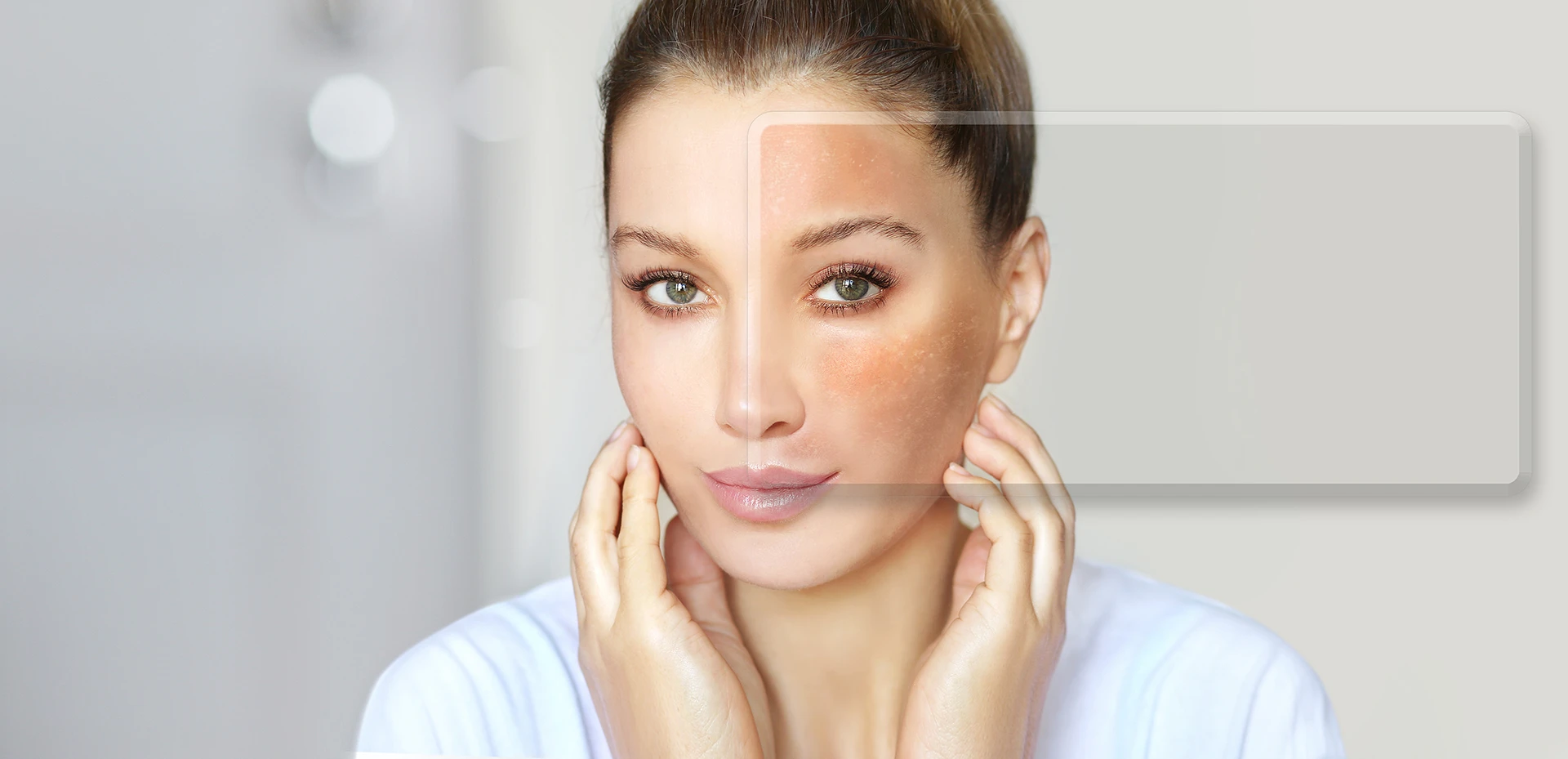 Breakthroughs in Melasma Treatment: How PicoSure Laser Pigment-Seeking Technologies and Combination Treatments Are Changing Melasma and Hyperpigmentation Treatment