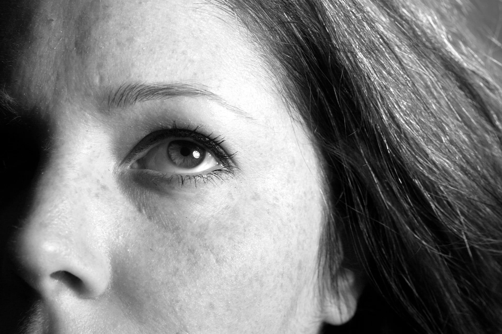 Breakthroughs in Melasma Treatment: How PicoSure Laser Pigment-Seeking Technologies and Combination Treatments Are Changing Melasma and Hyperpigmentation Treatment