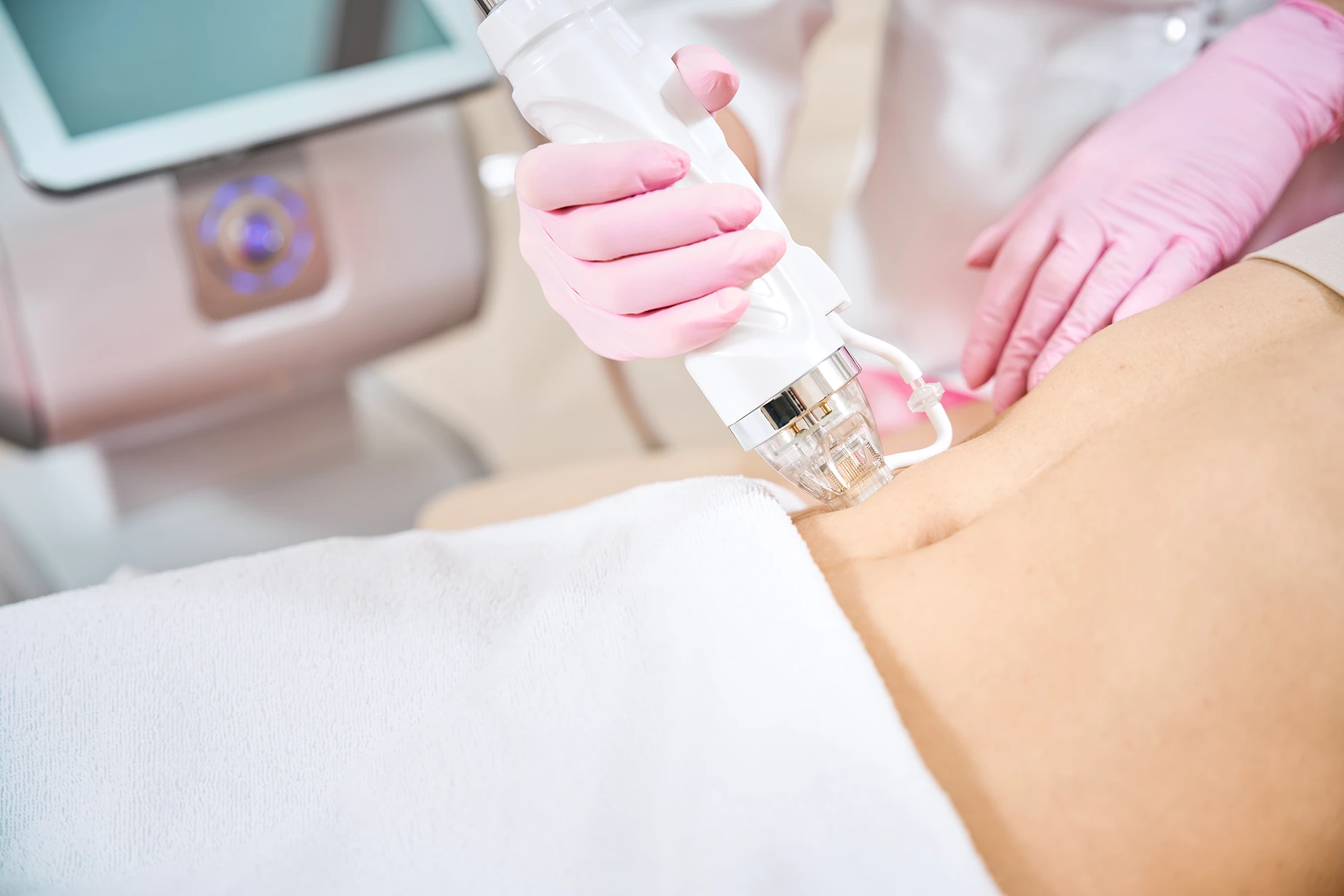 Microneedling with Exosomes (2026): Advances in Regenerative Aesthetics. The Future of Skin Rejuvenation, Hair Restoration, and Longevity Medicine