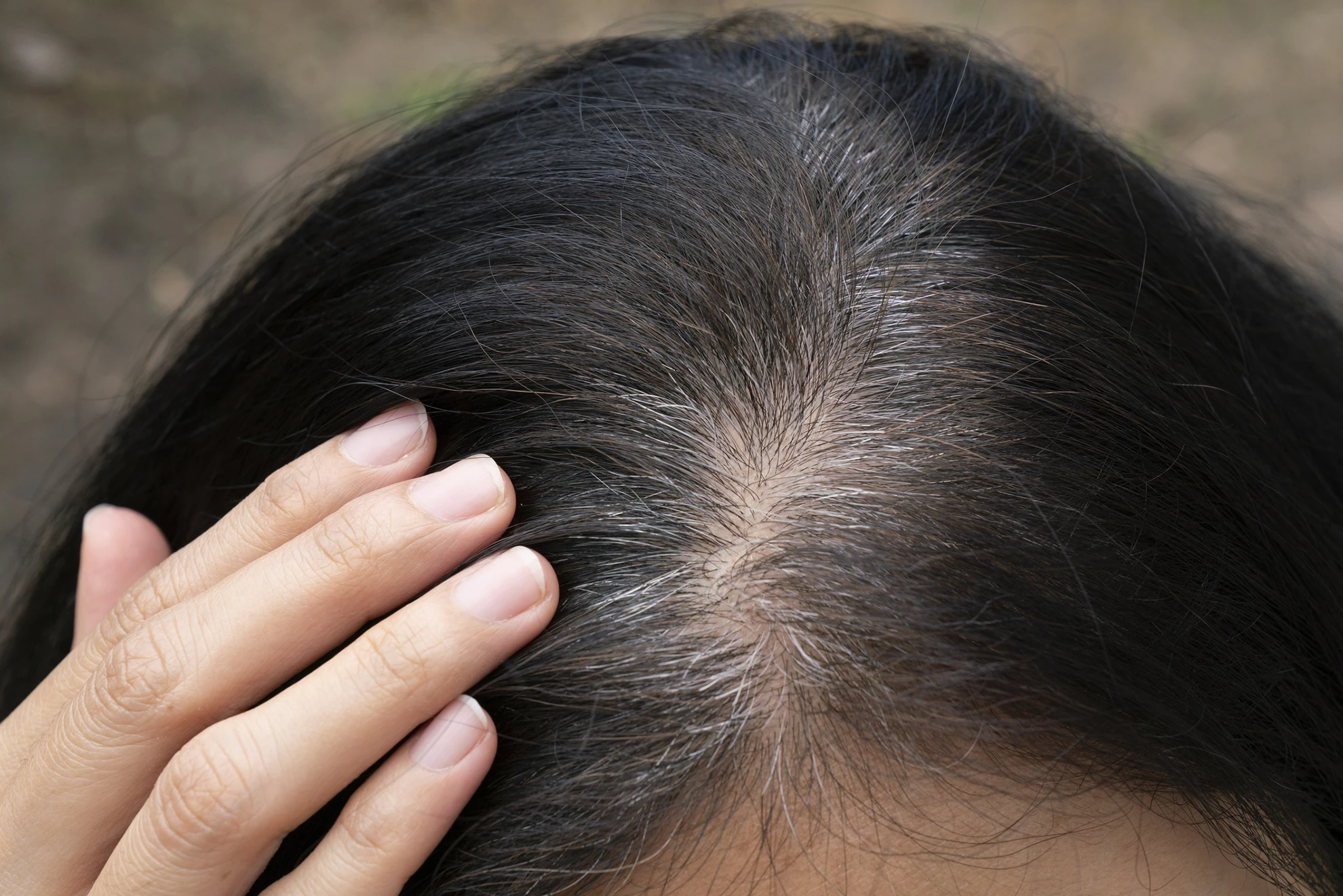 Is Stem Cell Therapy for Hair Loss Different for Men and Women? The New Science of Regenerative Hair Restoration