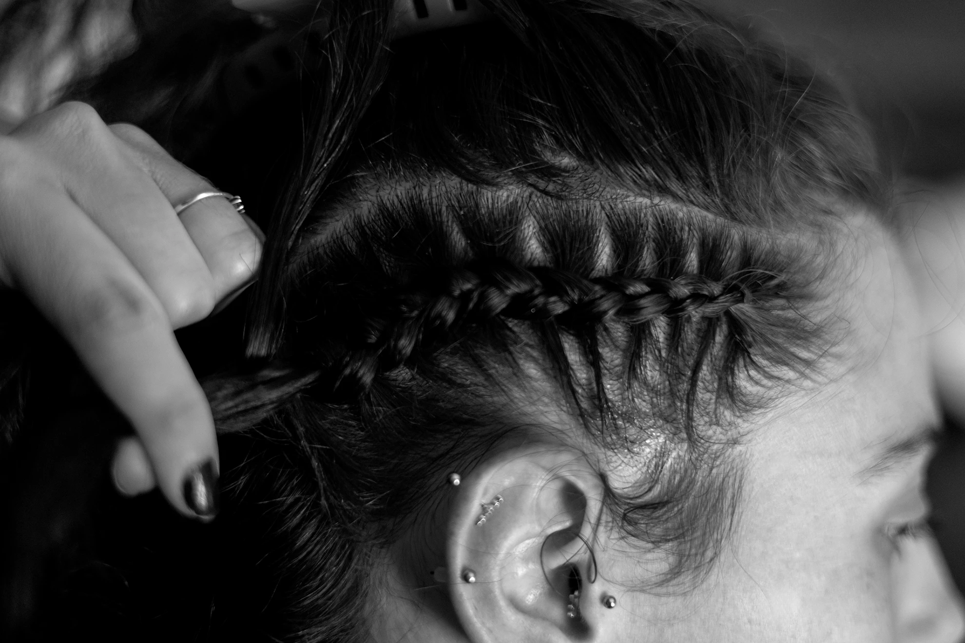 Does Stress Cause Hair Loss? Is it Different for Men and Women, and Can Modern Medicine Help?