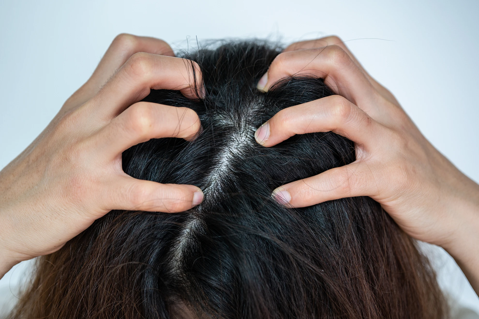 Does Stress Cause Hair Loss? Is it Different for Men and Women, and Can Modern Medicine Help?